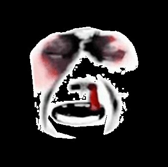 被揍